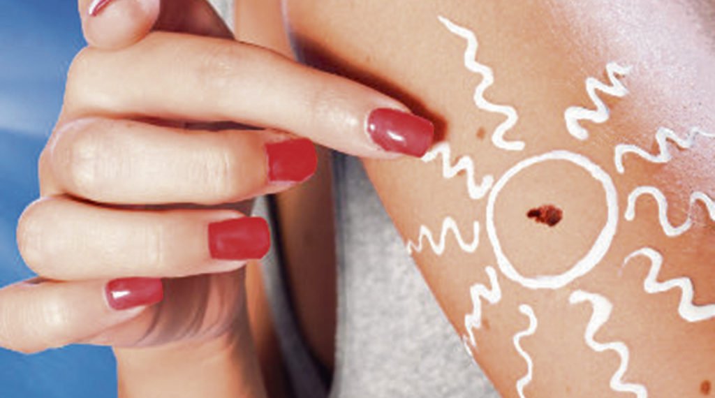 Chegada do verão alerta sobre os riscos e cuidados com a pele