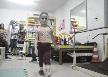 Aos cinco anos, Suany conseguiu caminhar sem dor pela primeira vez