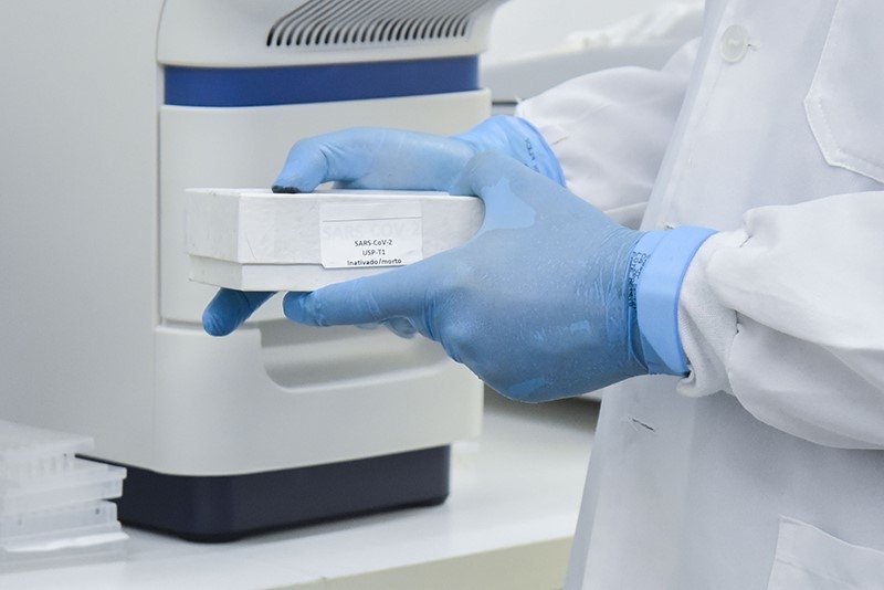 Feevale preparada para realizar diagnóstico laboratorial de Covid-19 em parceria com municípios da região