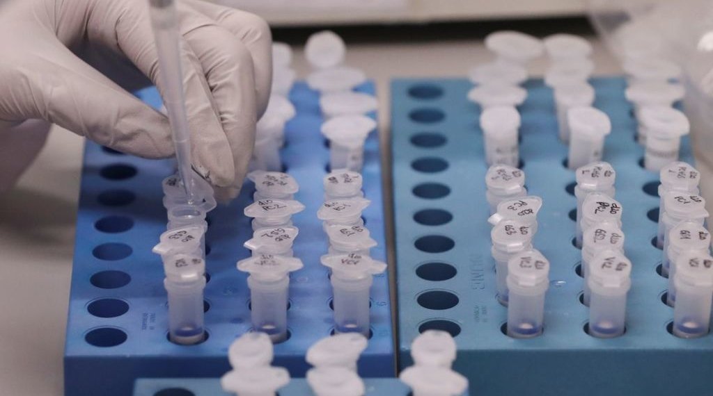 Mais de 1200 doses do imunizante CoronaVac foram aplicadas hoje 1 O avanço silencioso da COVID-19 entre os campo-bonenses