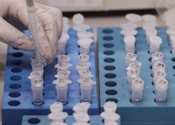 Mais de 1200 doses do imunizante CoronaVac foram aplicadas hoje 4 O avanço silencioso da COVID-19 entre os campo-bonenses