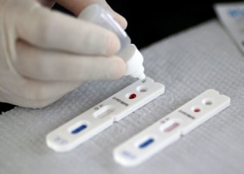 Prefeitura compra 2 mil novos testes de Covid-19