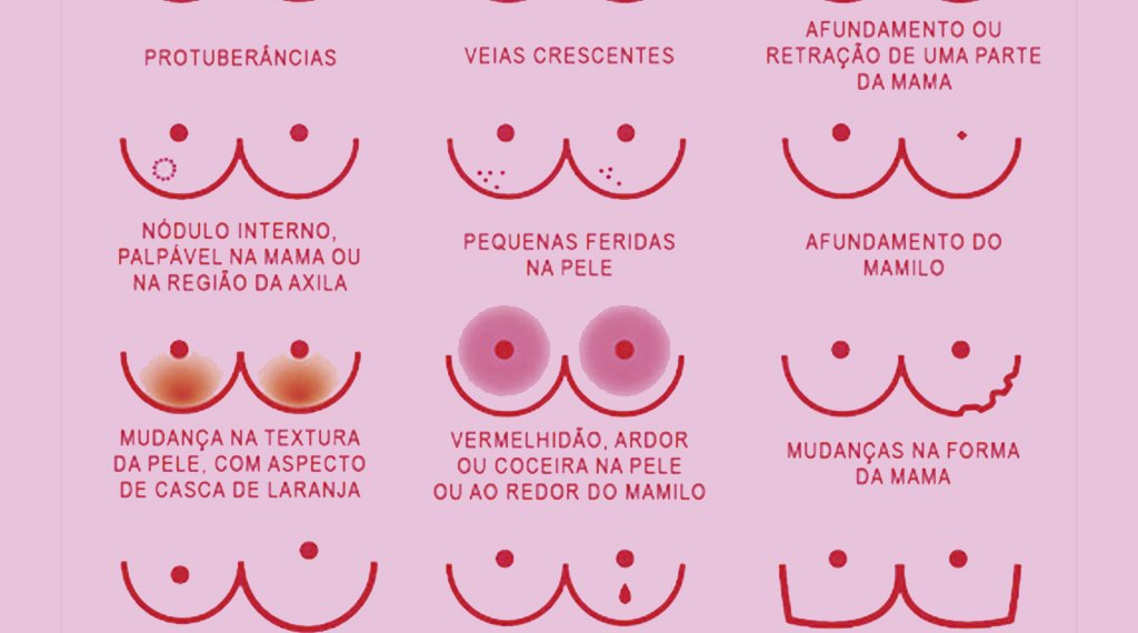 Outubro Rosa: Ame-se, toque-se, previna-se 1 Outubro Rosa: Ame-se, toque-se, previna-se