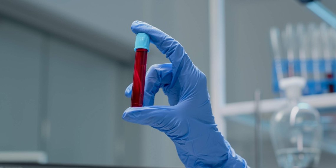 Exames de pacientes oncológicos do Hospital de Taquara passam a ser realizados em Campo Bom 1 Exames de pacientes oncológicos do Hospital de Taquara passam a ser realizados em Campo Bom