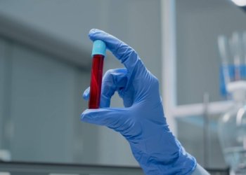 Exames de pacientes oncológicos do Hospital de Taquara passam a ser realizados em Campo Bom