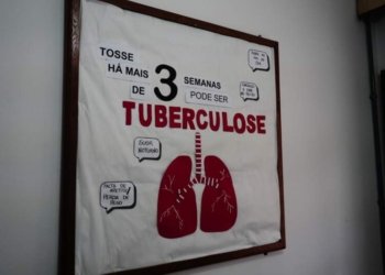 Centro de Testagem e Aconselhamento (CTA) alerta sobre os cuidados com a tuberculose