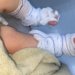 Criança que sofreu queimaduras segue internada, família faz manifestação e hospital emite boletim médico